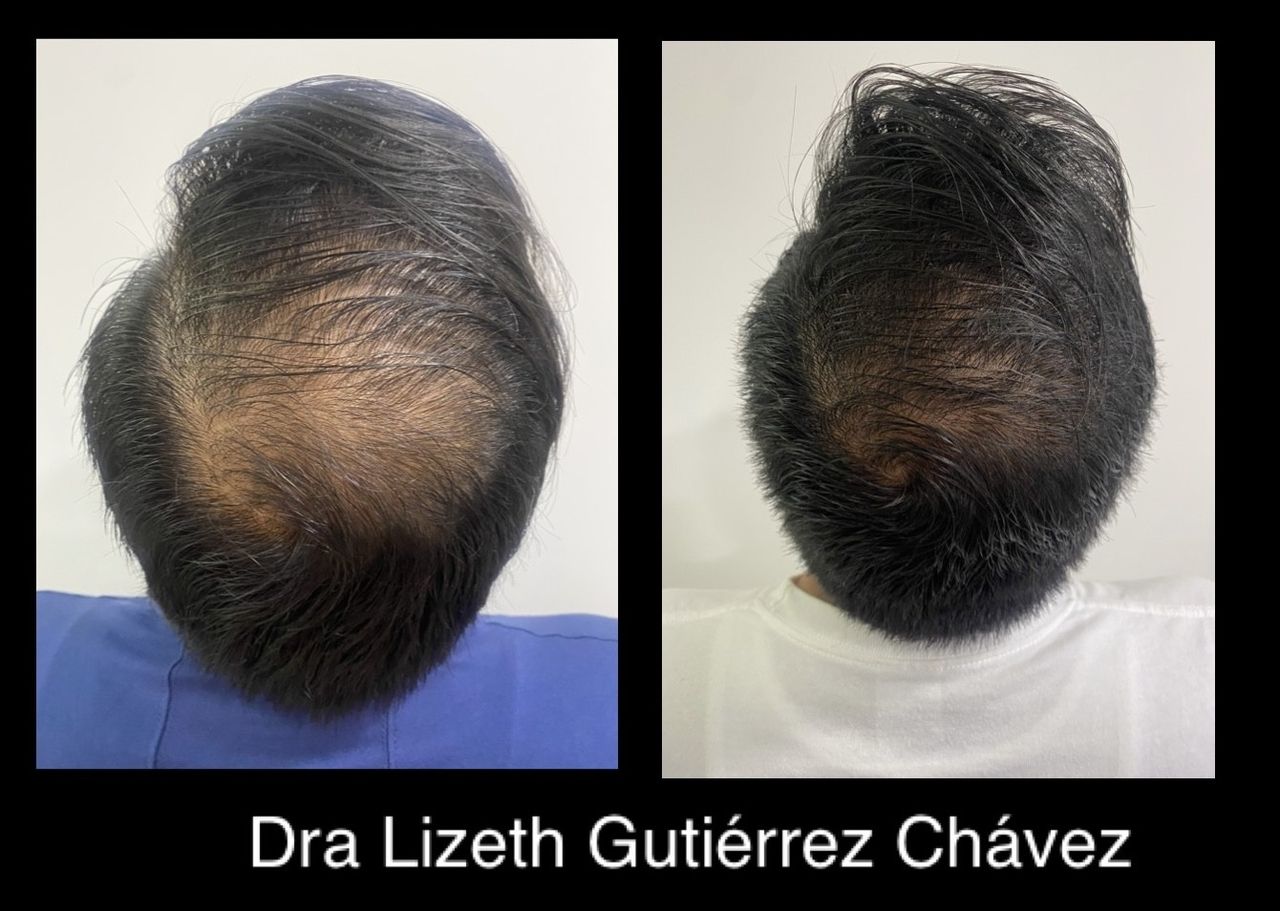 Lizeth Alejandra Gutiérrez Chavéz-1