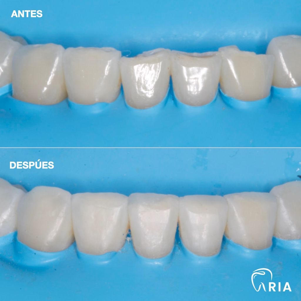 Mariel Itzayani Torres López-30