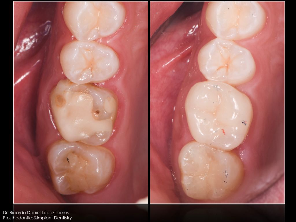 Ricardo López Lemus-51