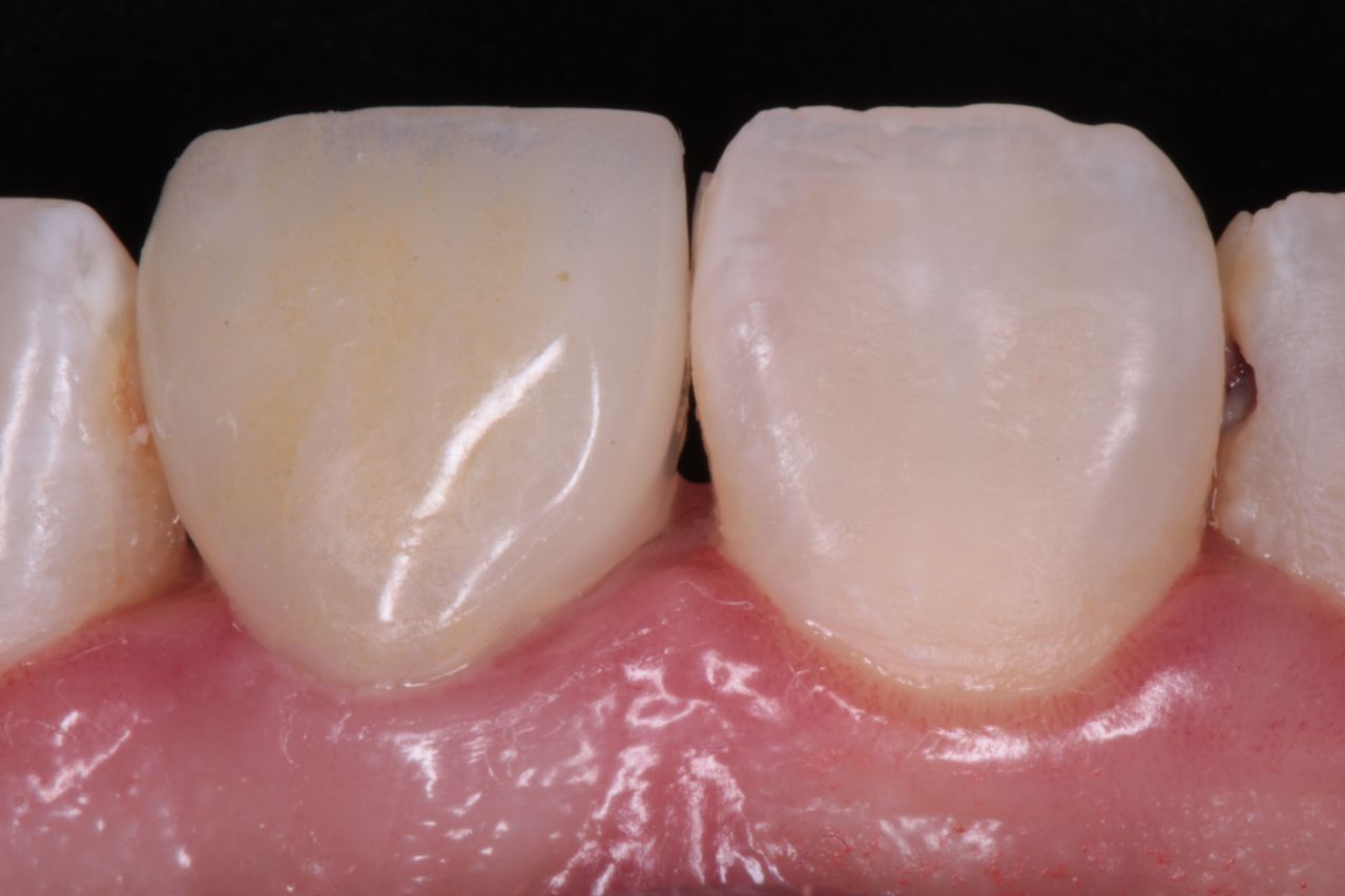 David Alan Escamilla Álvarez-1