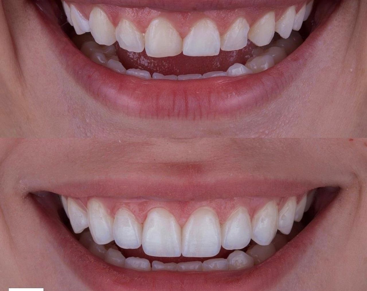 Ernesto Rojas Calderon-45