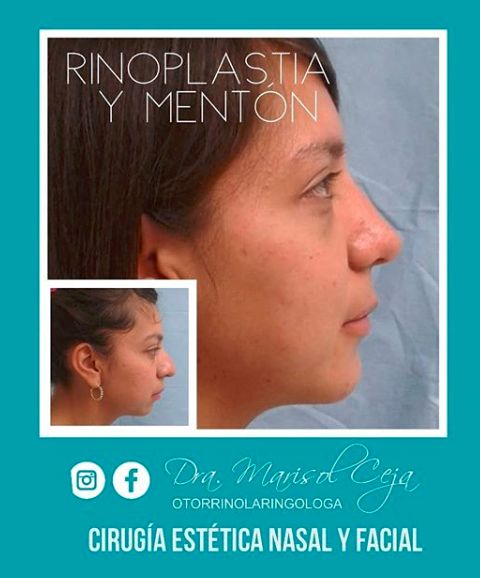 Marisol Ceja Zepeda-56