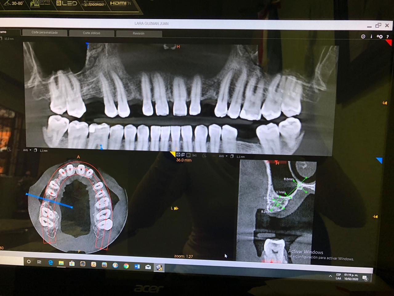 Zuleica Vera Apan-65
