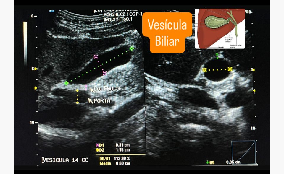 Ana Itzel Gaona Guevara-3