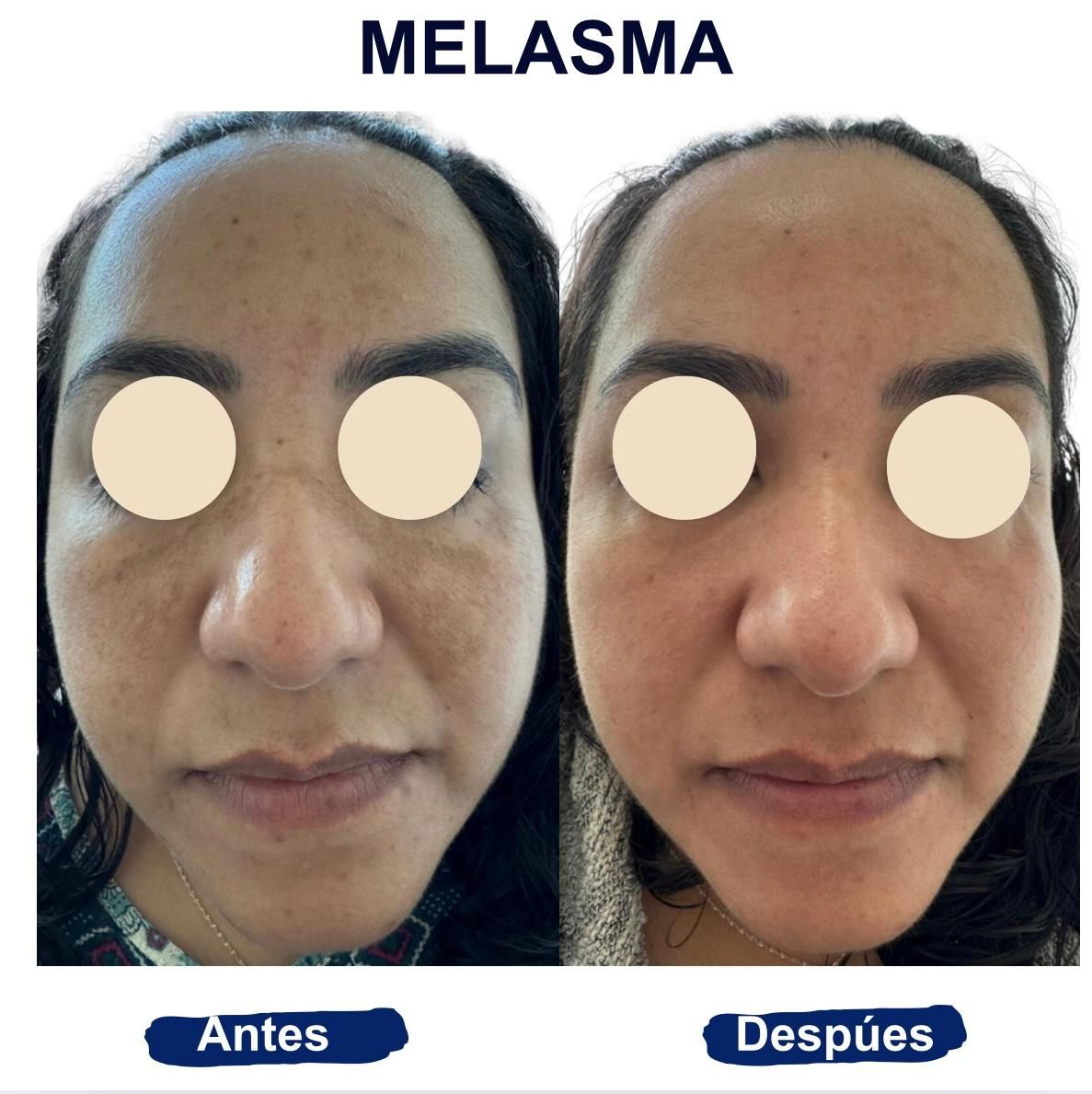 Itzel Anayn Flores Reyes-12