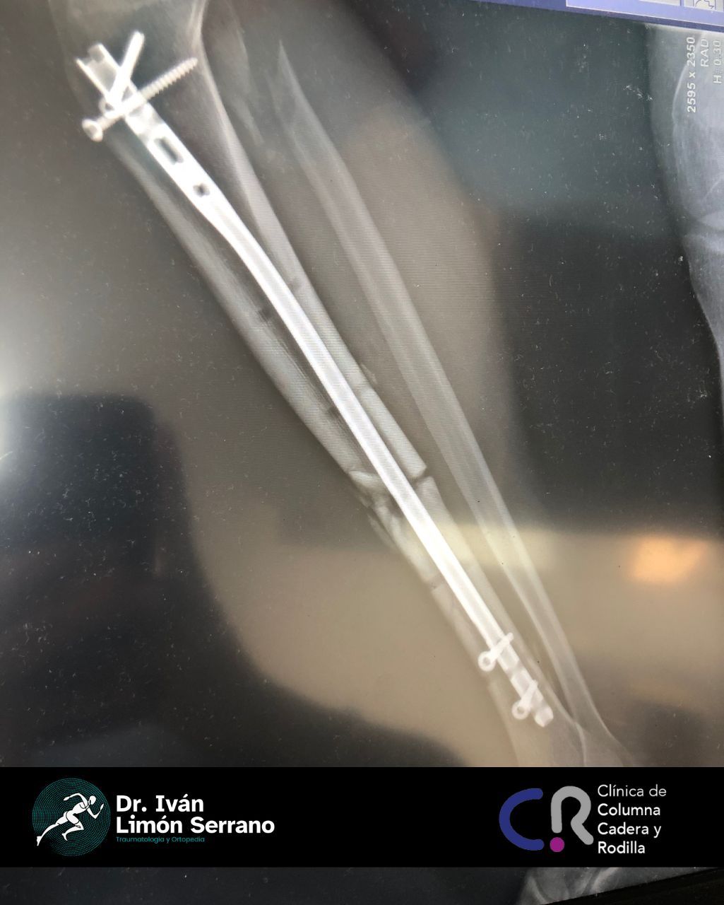 Iván Limón Serrano-40