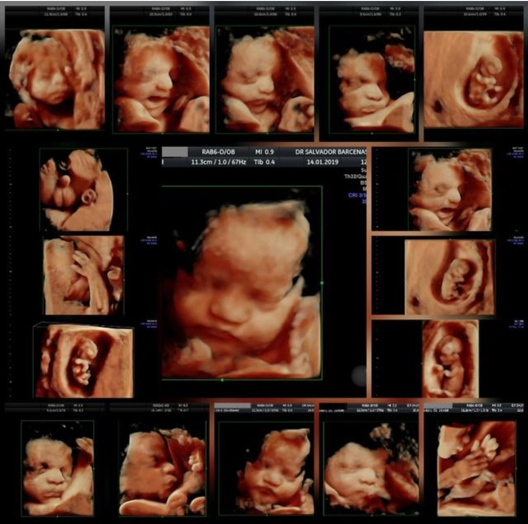 Salvador Barcenas Bravo-6