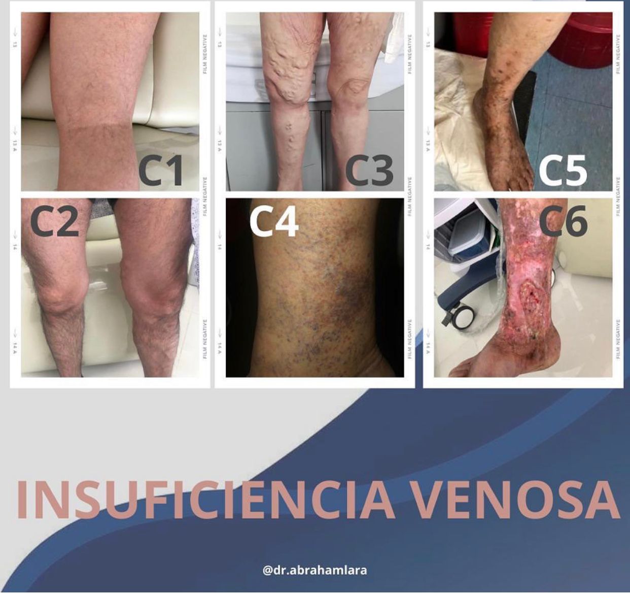 Miguel Abraham Lara Perez-39