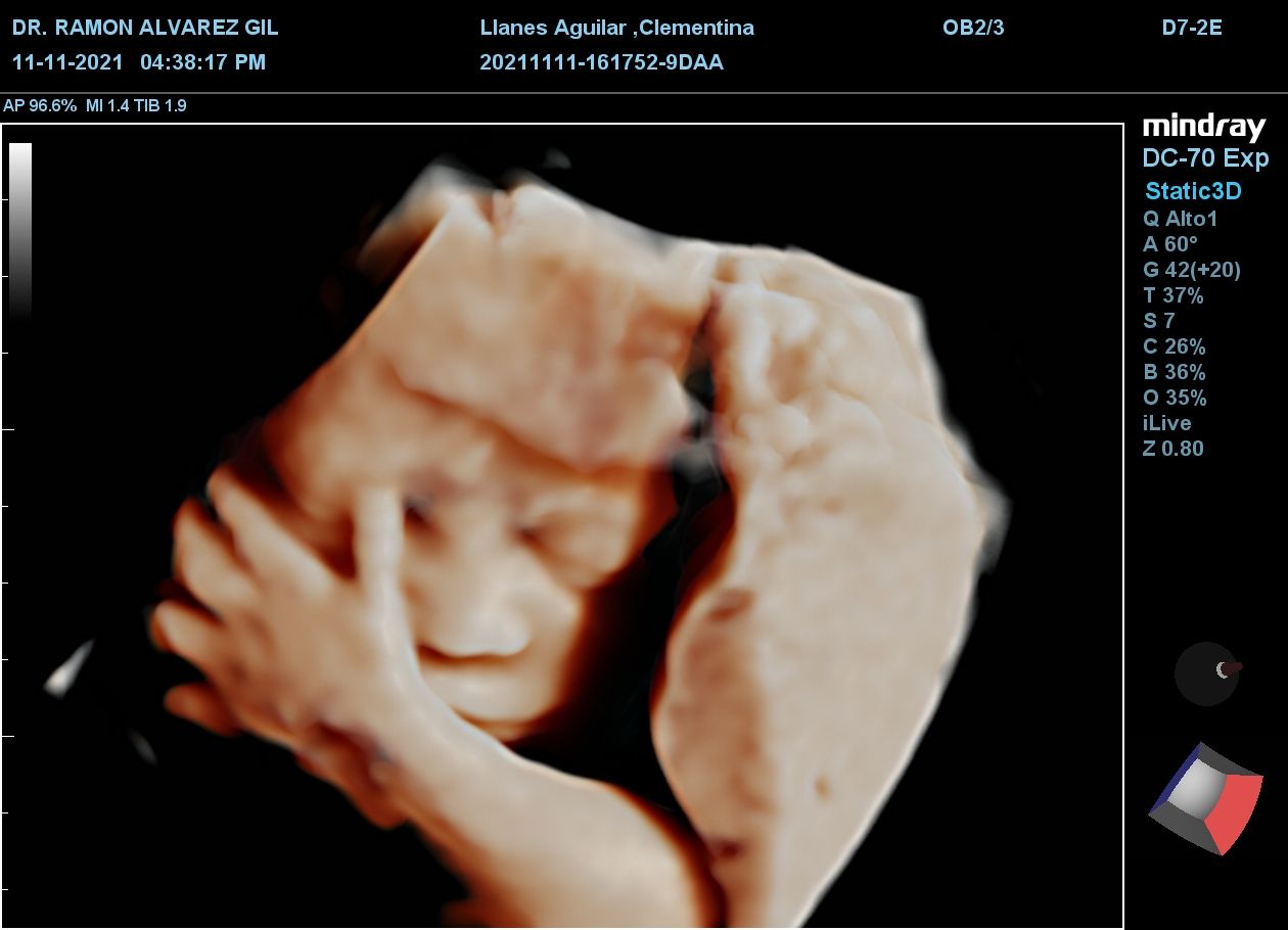 Ramón Antonio Alvarez Gil-6