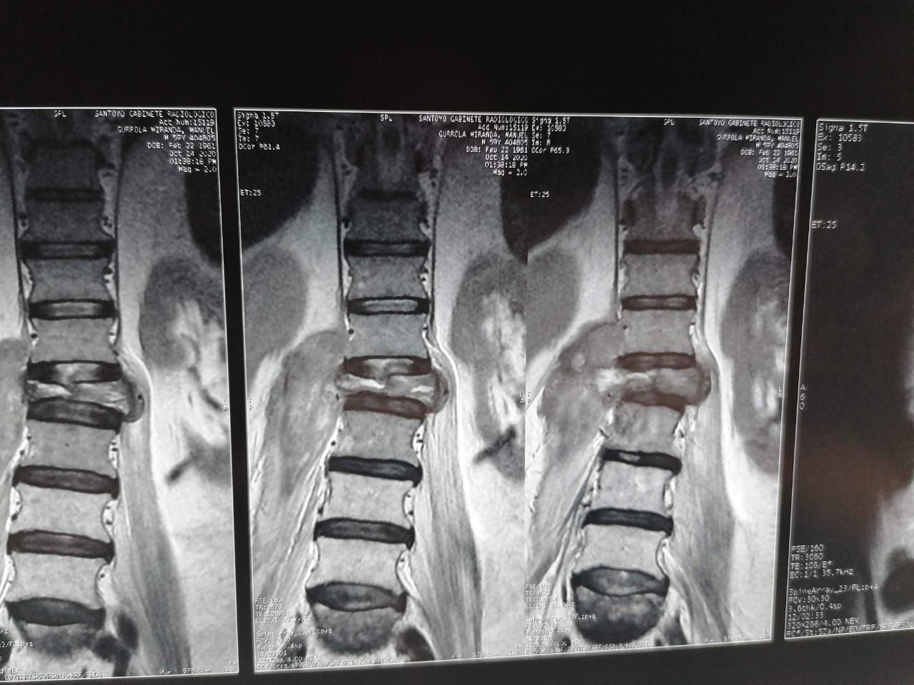 Juan José Luévano De La Cruz-49