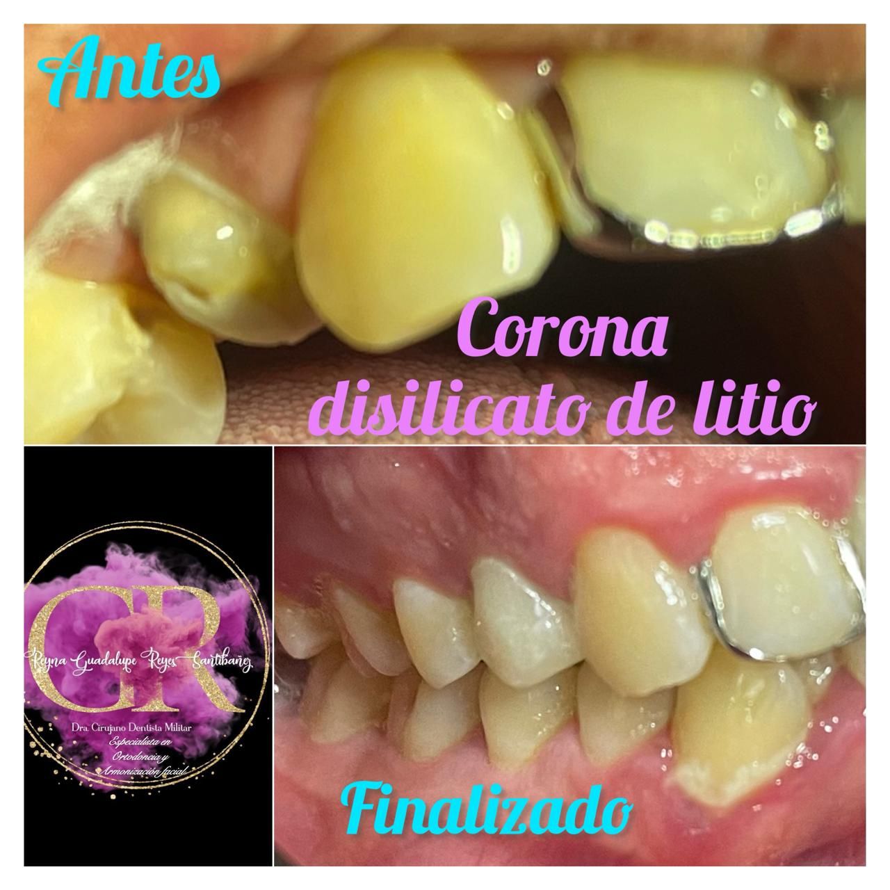 Reyna Guadalupe  Reyes Santibañez-3