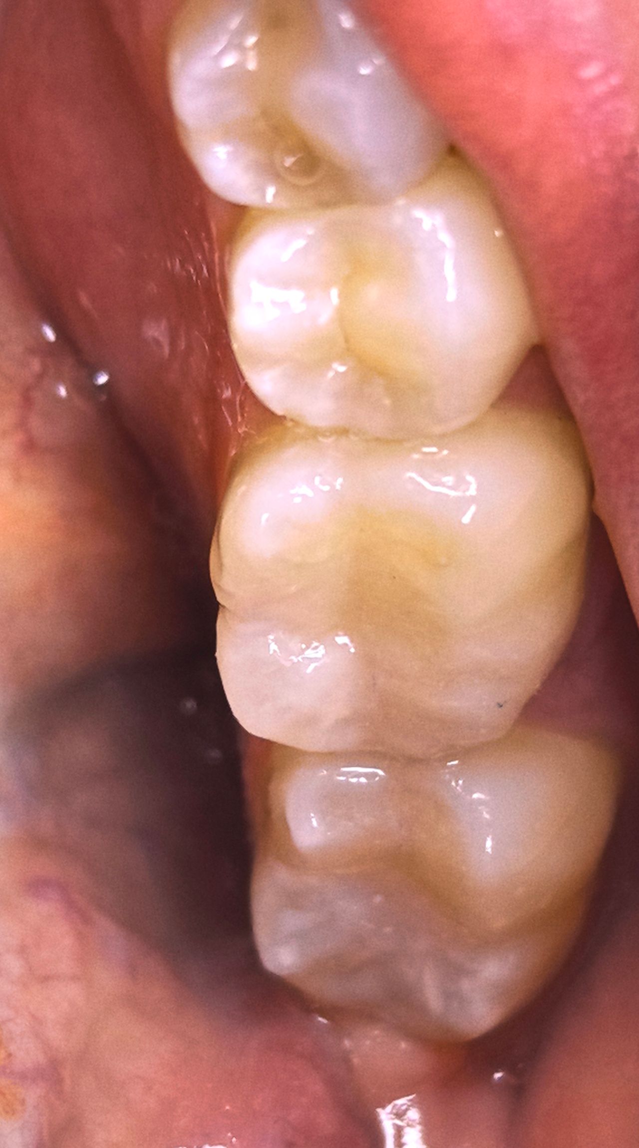 Ilse Nair Anaya Gutiérrez-4