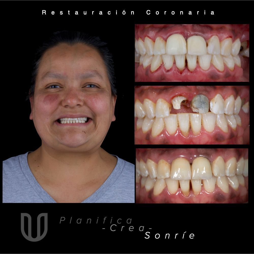 Erika Nayeli Olivares Puente-15
