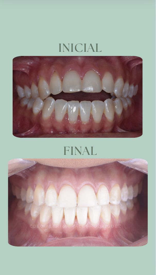 Alerí Morales Rodríguez-3