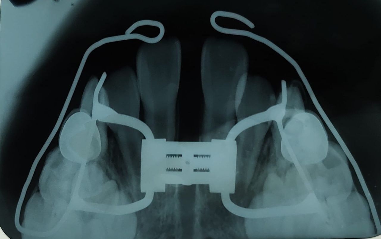 Aimée Quiroz Mendoza-24