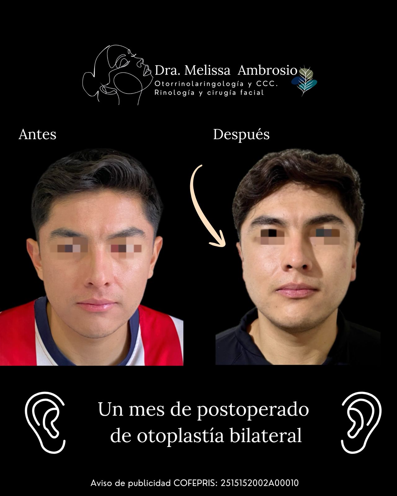 Melissa Guadalupe Ambrosio Mendoza-19