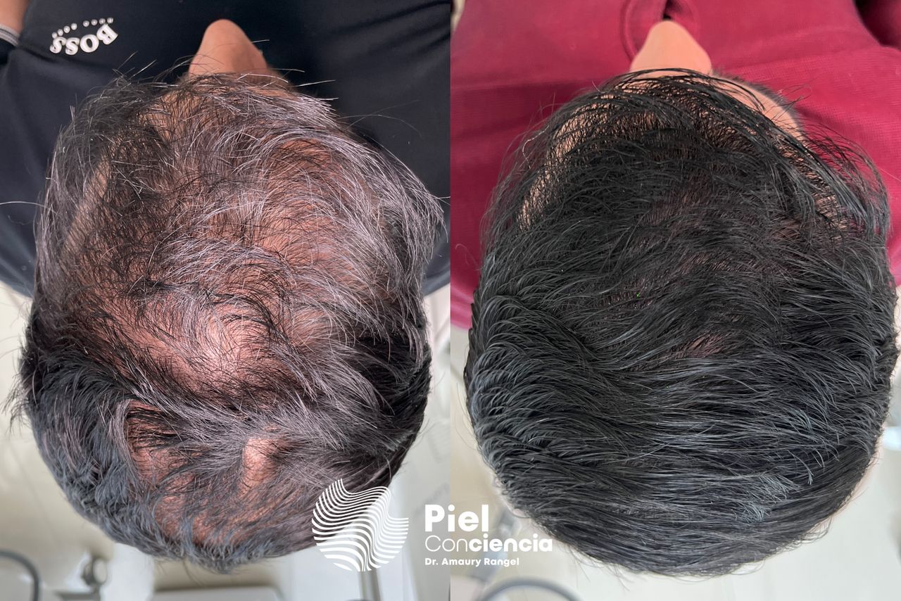 Víctor Amaury Rangel Avilés-30