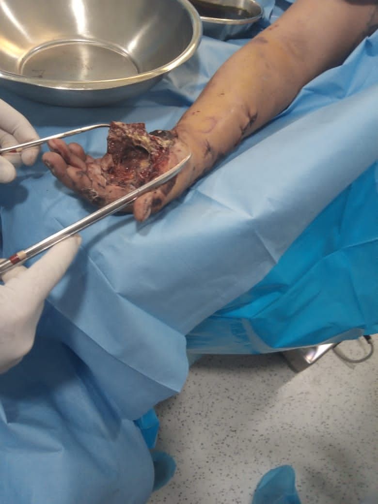 Federico Quintana De La Rosa-45