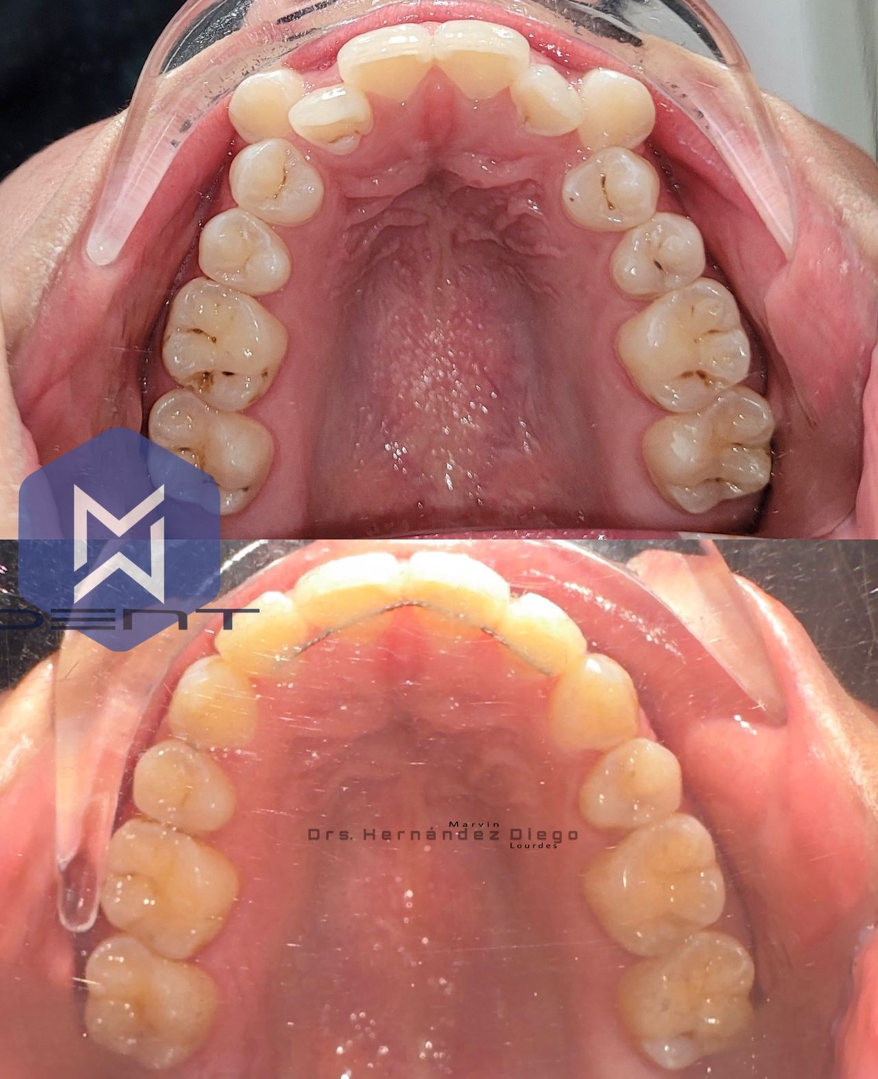 Marvin Adair Hernández Álvarez-21