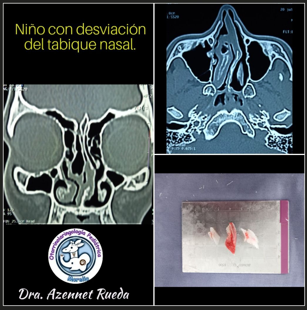 Azennet Rueda Rodríguez-9