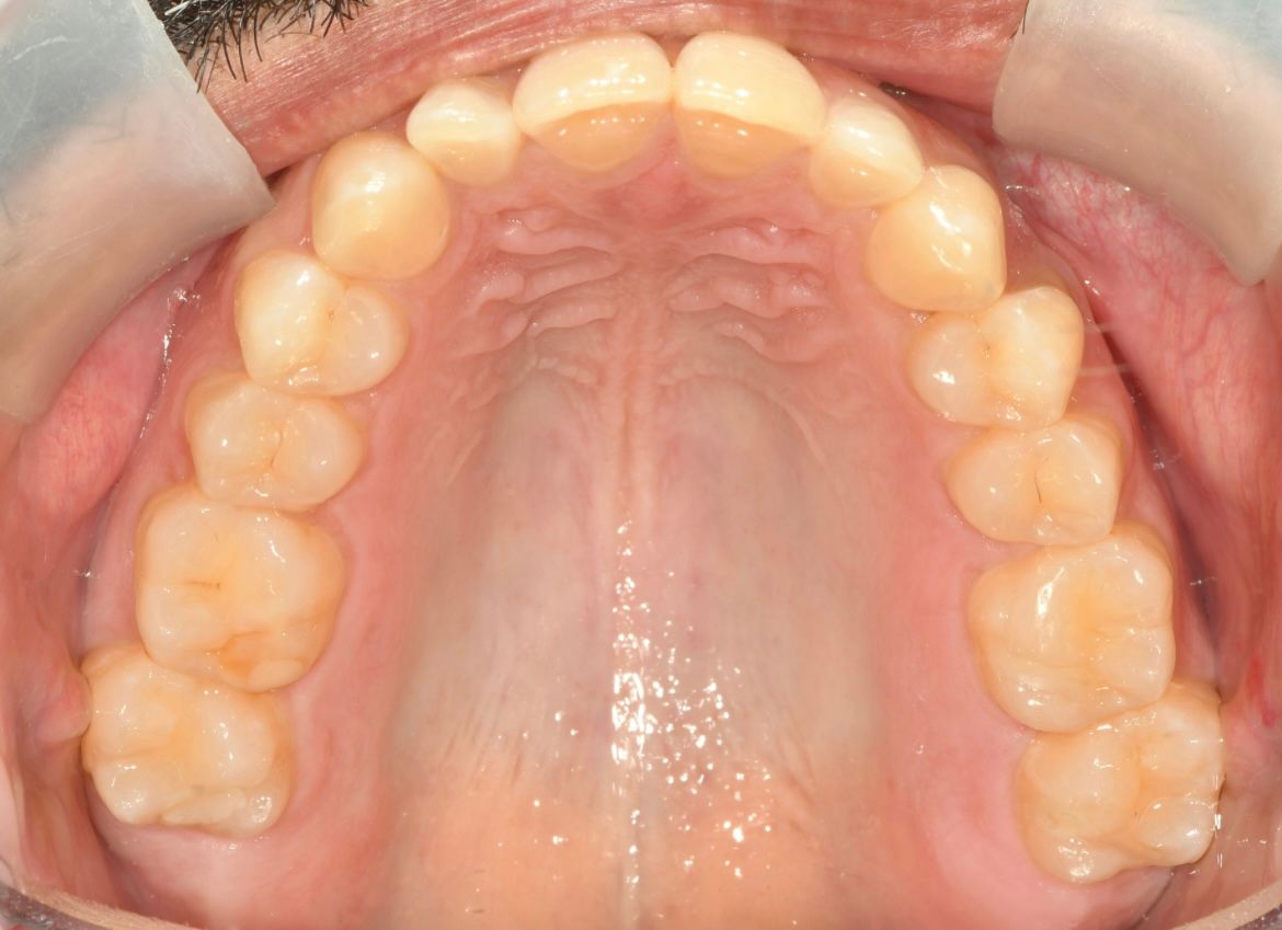 Adriana Ascanio Inciarte-3