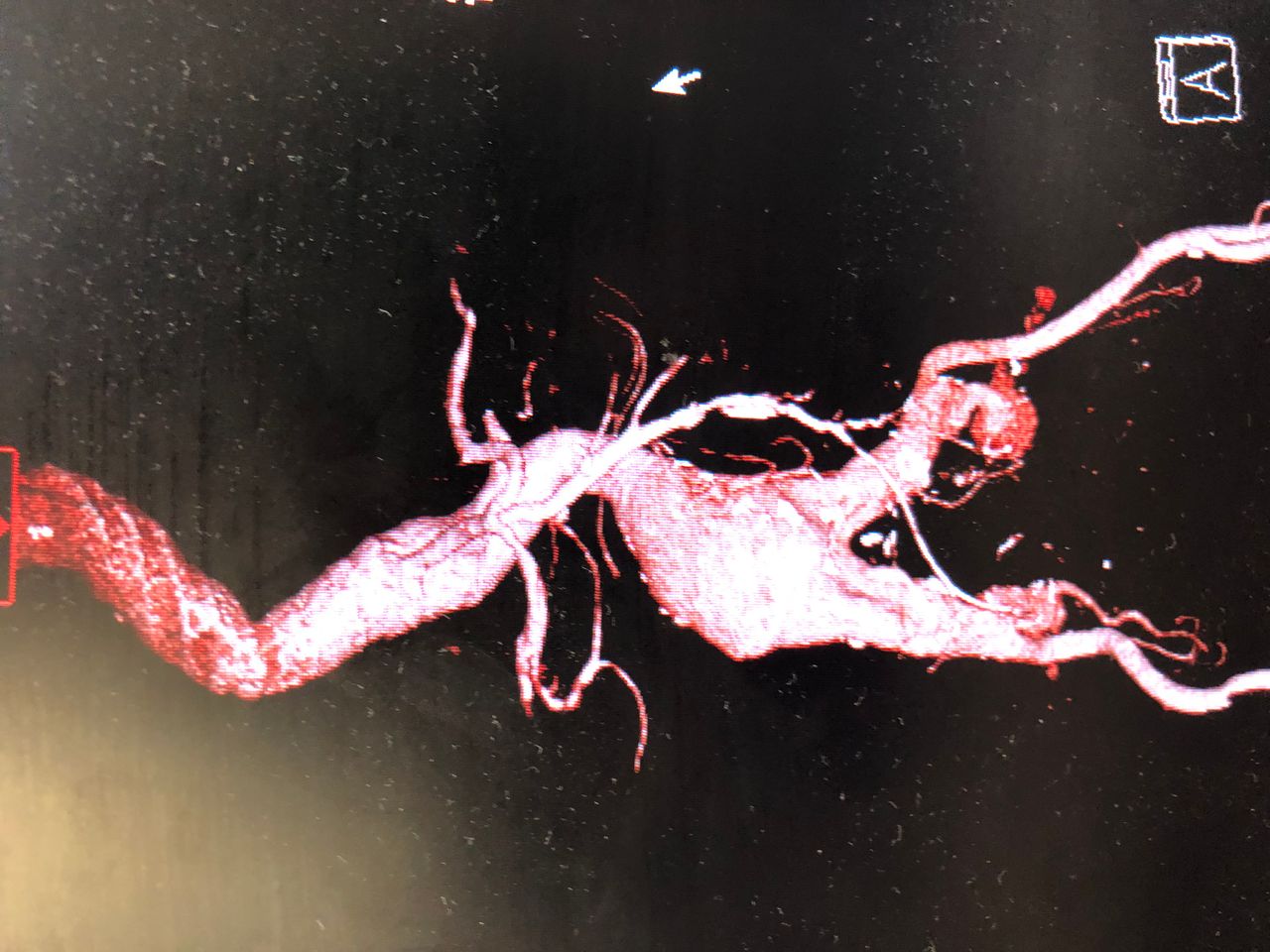 Edgar Renato Calvillo Morales-0