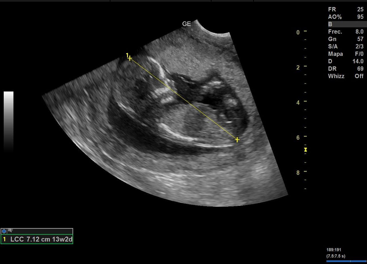 Graciela Elizabeth De La Torre Alvarez-20