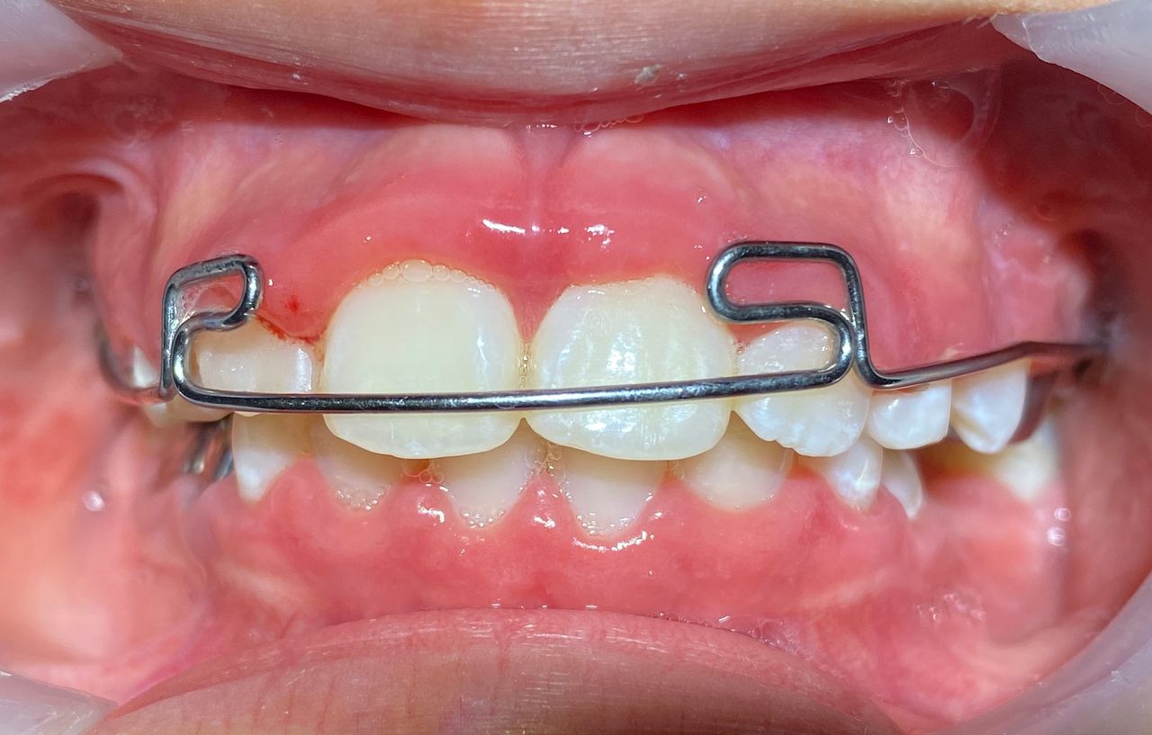 Mirely Peralta Rodríguez-8