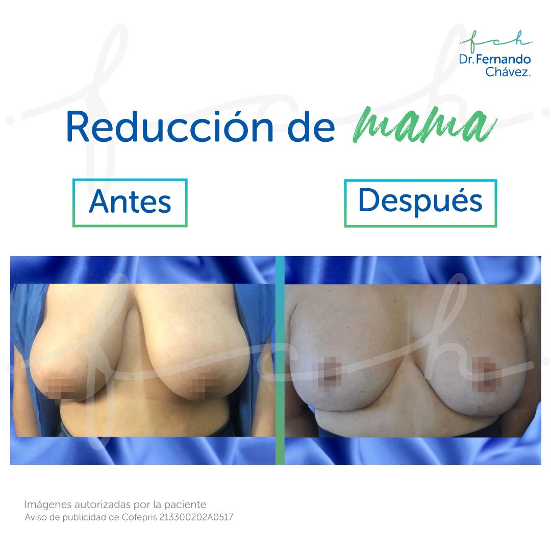 Fernando Chávez Osorio-13