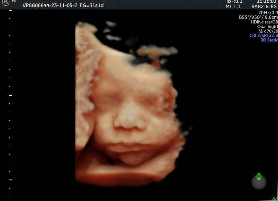 Alejandra Alonso Martínez-3