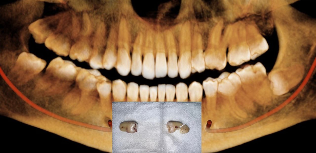 Luis Angel Carranza Resendez-0