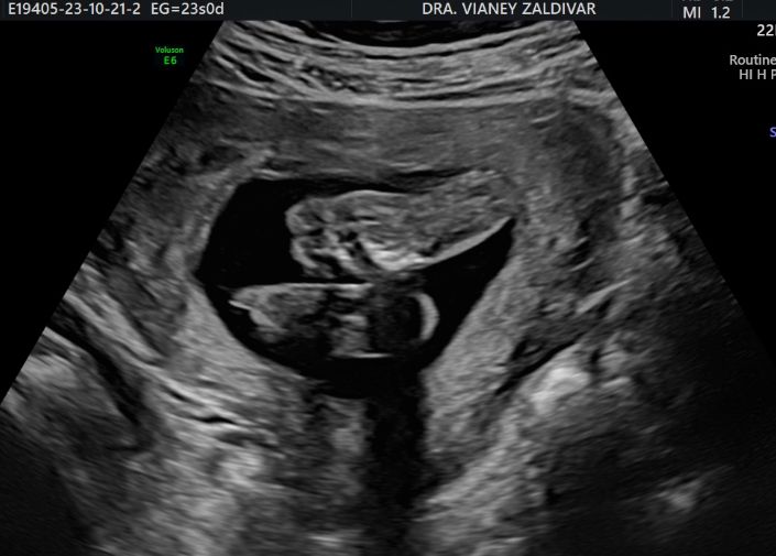 Lourdes Vianey Zaldivar Estrada-7