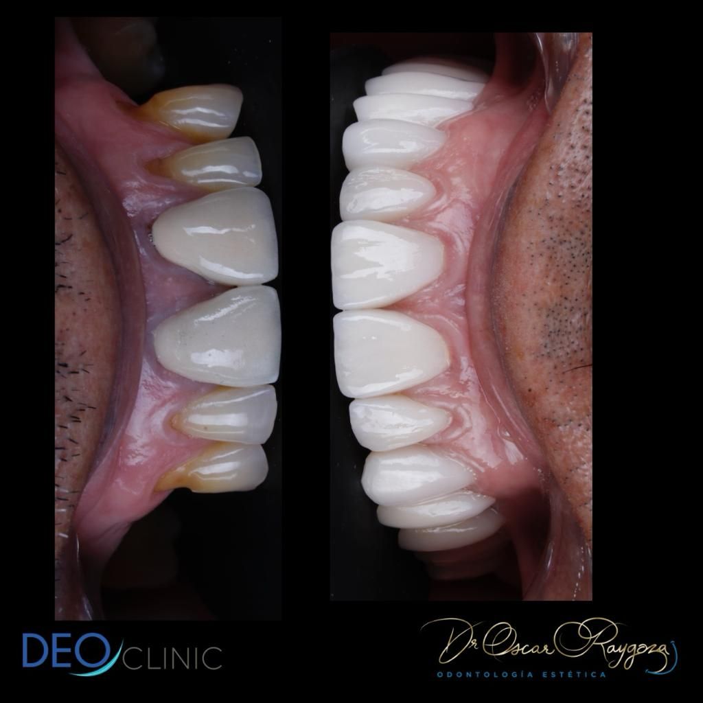 Oscar Raygoza Carrillo-4