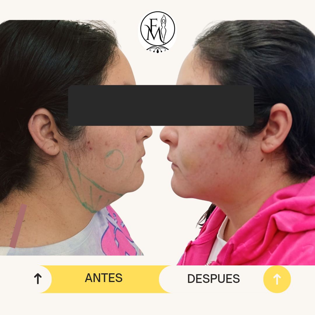 Montserrat Flores Velazquez-16