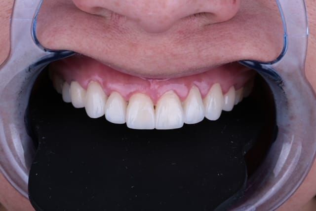 Edgardo Caballero Dávila-1