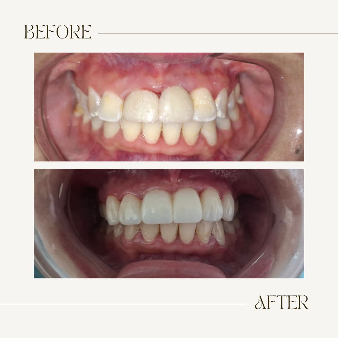 Susana Cherta Perez-8