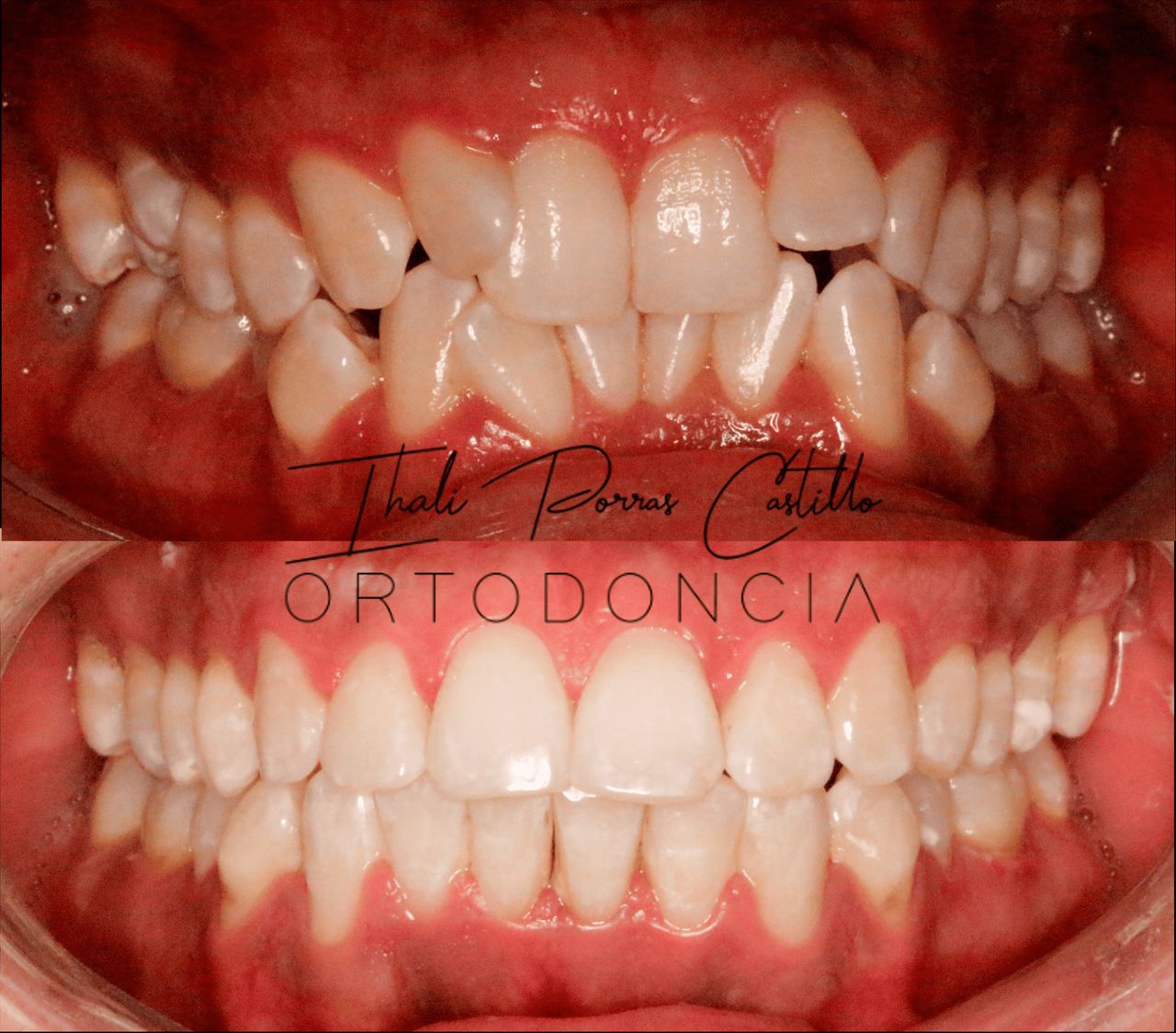 Ihali Porras Castillo-8