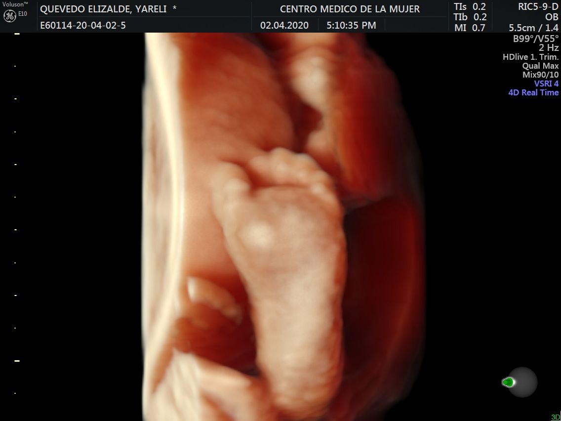 Julio Cesar Monárrez Martín-23