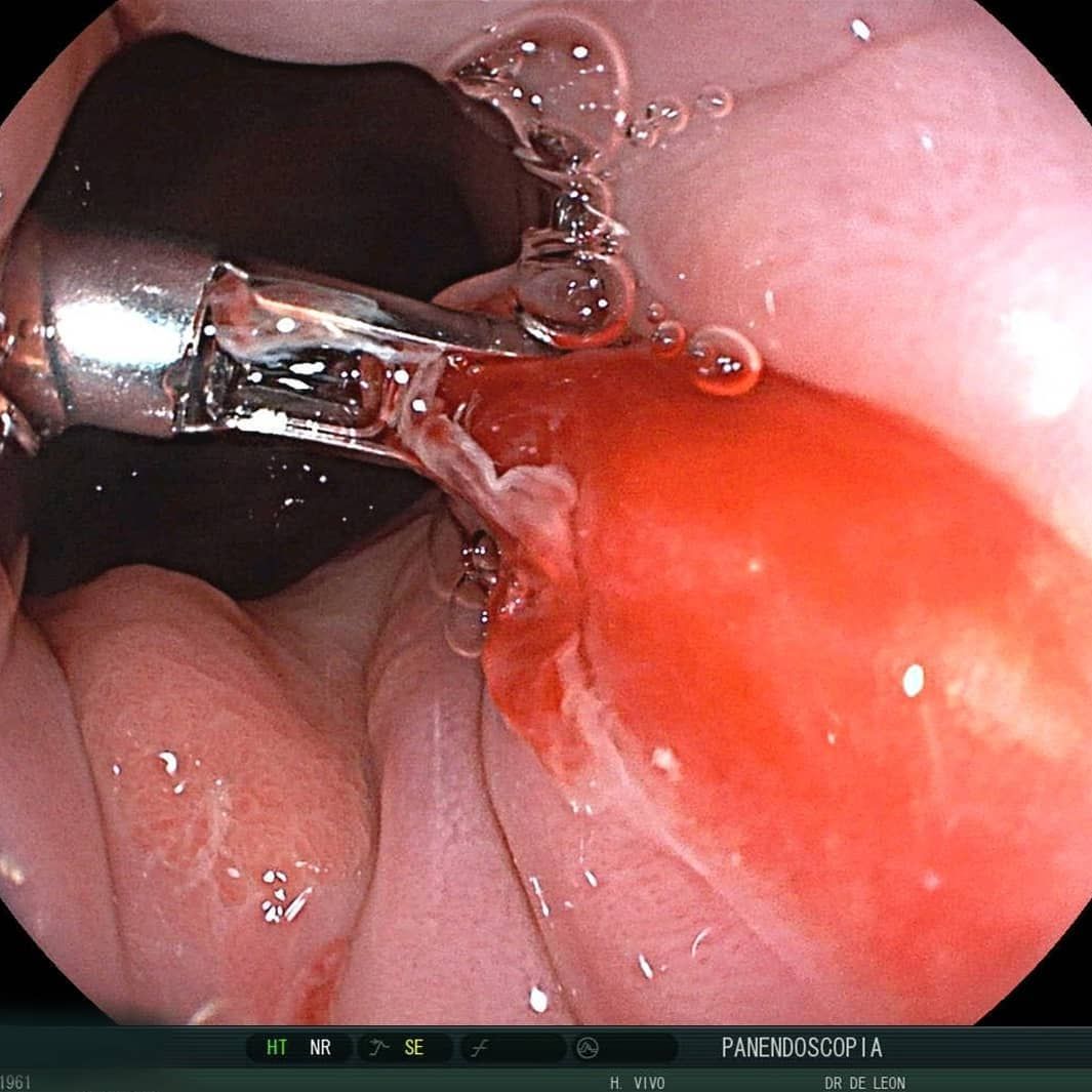 Edgar Alan De León Rojas-22