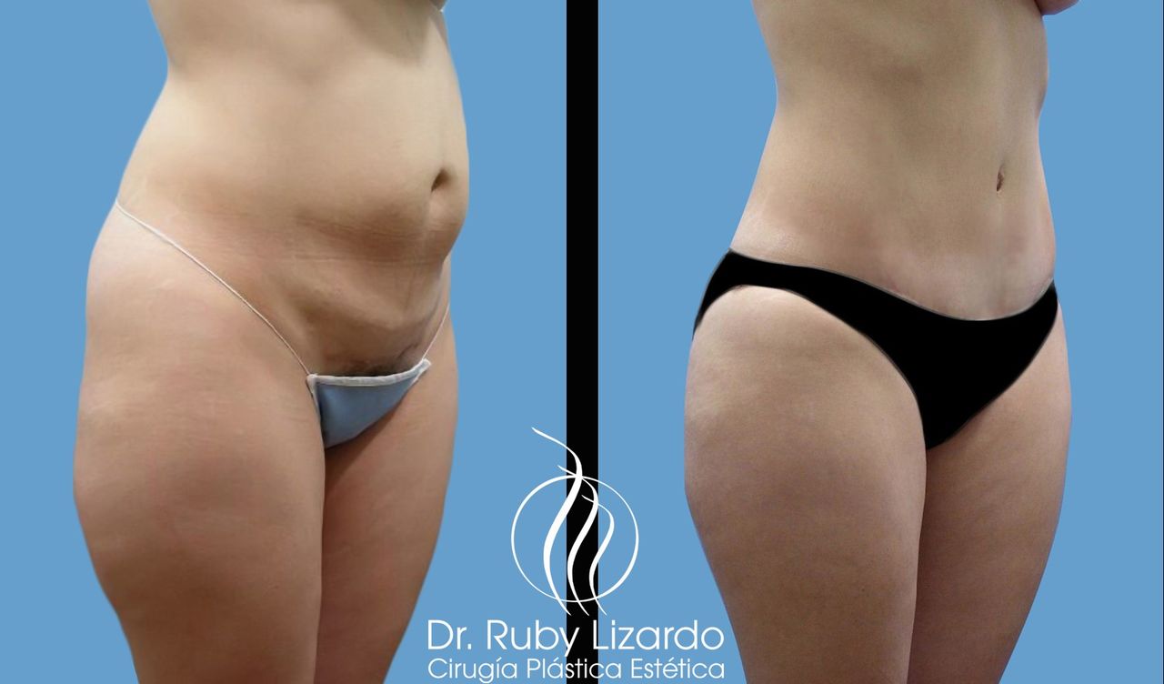 Ruby Lizardo Ramírez Robles-15