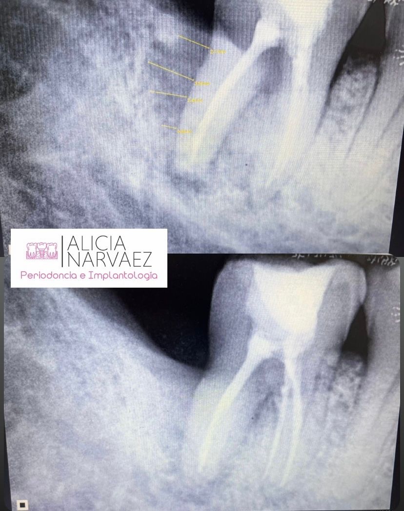 Alicia Narváez Chávez-3