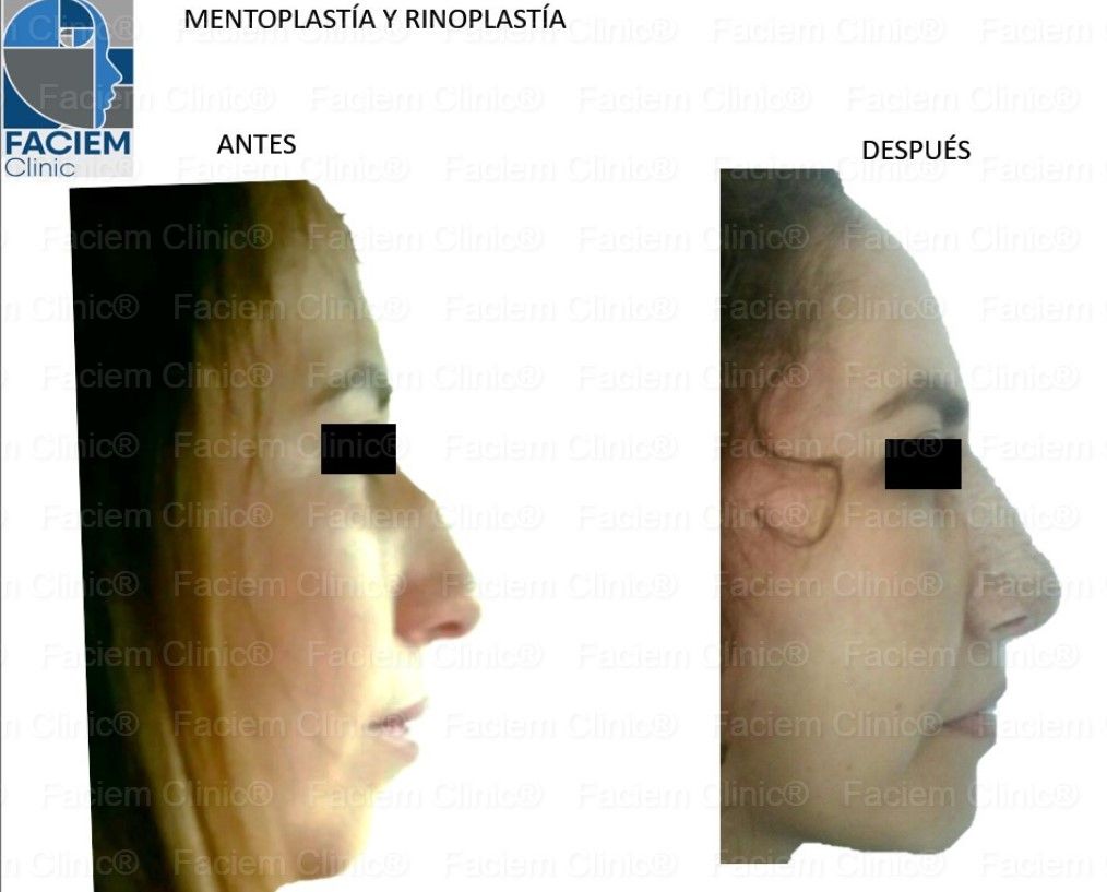 Arlen Colín Ordaz-10