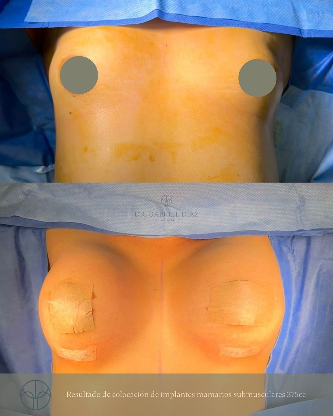 Gabriel Diaz Rosas-9