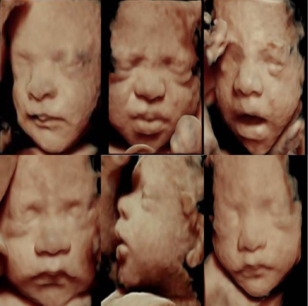 Edgar Alejandro Támez Cristerna-7