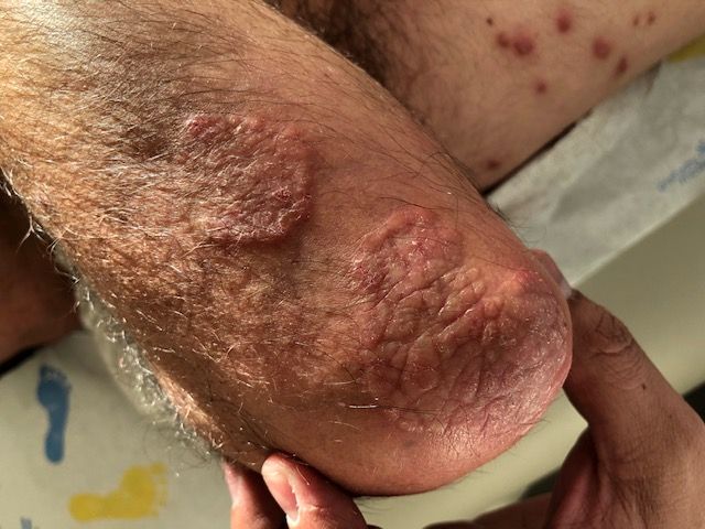 Joel Barroso Santos-58