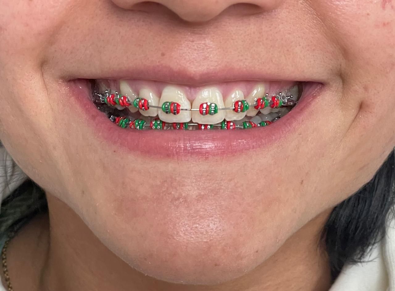 Anuar Becerril Castro-21