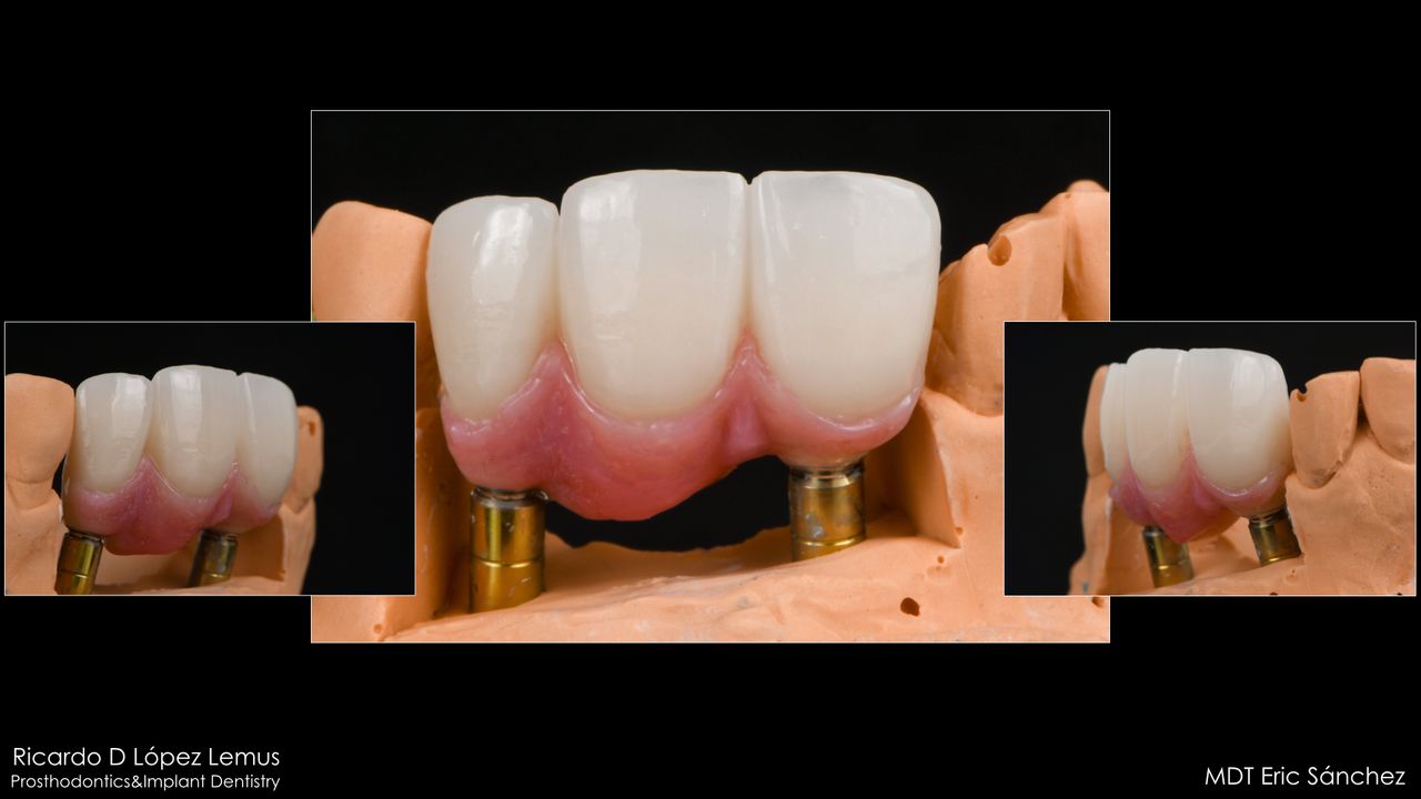 Ricardo López Lemus-24