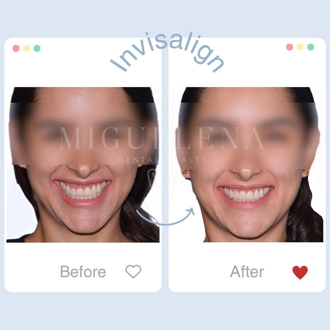 María Fernanda Miguelena-0