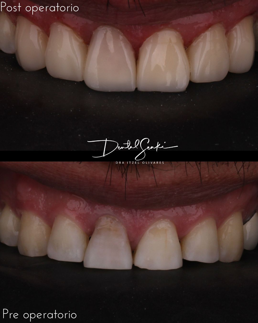 Itzel Olivares Lara-22