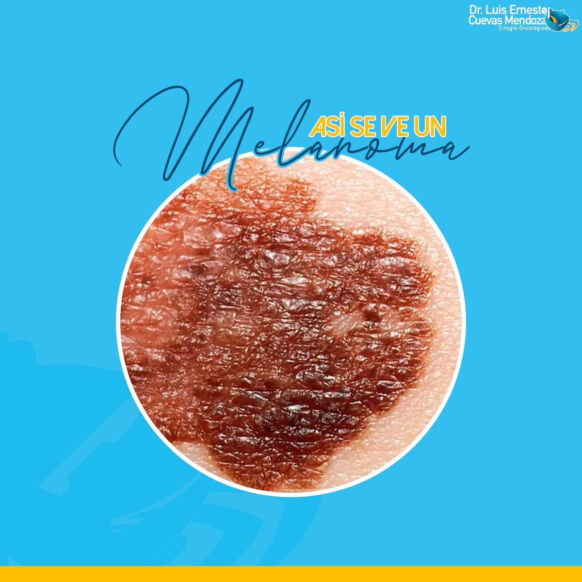 Luis Ernesto Cuevas Mendoza-3